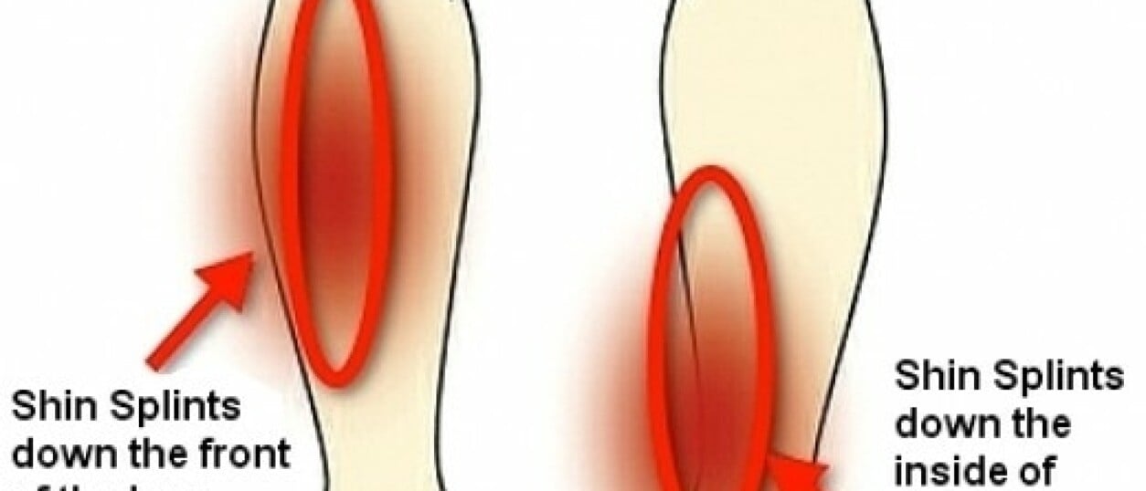 Alles Over Pijn In Het Scheenbeen Oorzaken En Behandeling