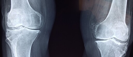 Bewegen slijt je knie? Waarom dit een fabel is bij knieartrose