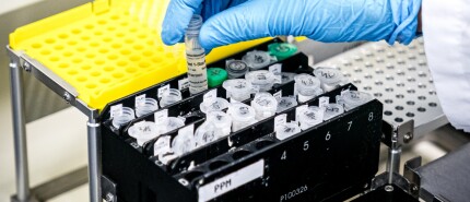 Diverse virussen en bacteriën achter hoog aantal longontstekingen