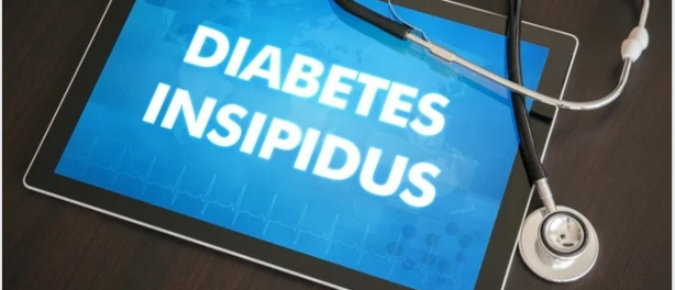 Diabetes insipidus