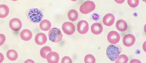 Schizonten