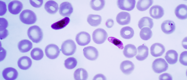 Plasmodium