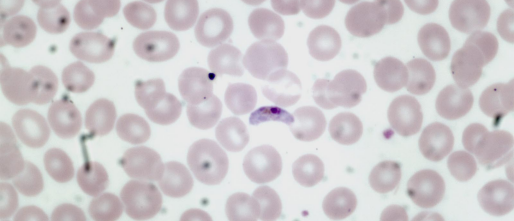 Plasmodium falciparum bestrijden