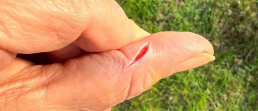 Een pleister heelt de wonde niet