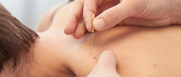 Dry needling bij SaFyR in Yerseke en Hansweert