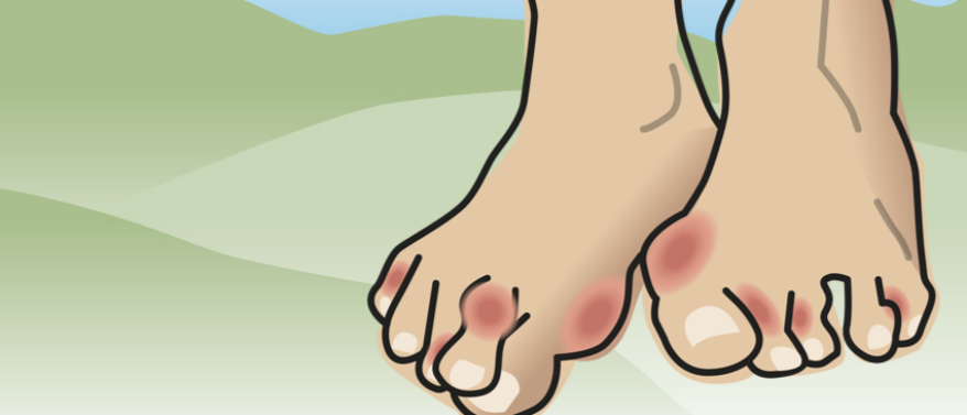 Pijnlijke liefde voor schoenen