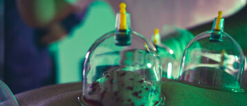 Wet Cupping: De kracht van eeuwenoude therapie bij Hijamakliniek Amsterdam