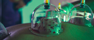 Hoge bloeddruk verlagen met hijama