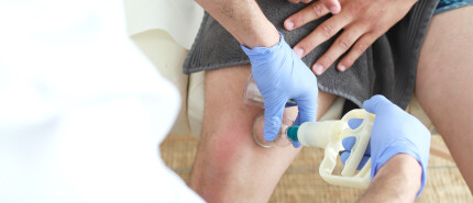 Hoe hijama helpt bij artritis en reuma