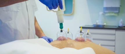 Wanneer kies je voor hijama en wanneer niet