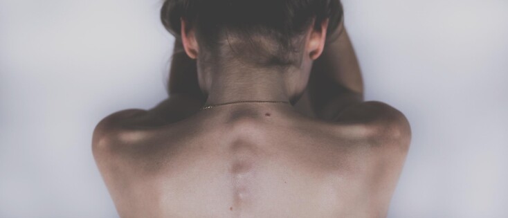 Costochondritis en pijn in je rug – hoe zit dat nou?