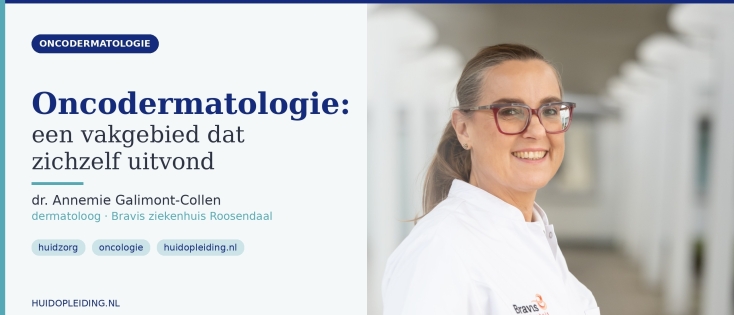Oncodermatologie: een vakgebied dat zichzelf uitvond