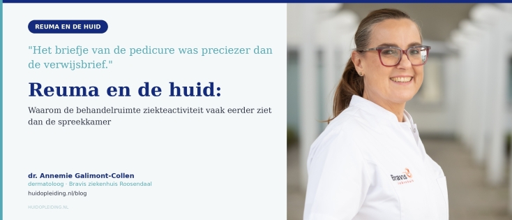 Reuma en de huid: het signaal ligt vaak in de behandelruimte