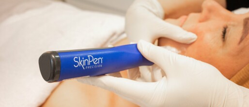 Ontdek de kracht van SkinPen Microneedling tegen acne littekens