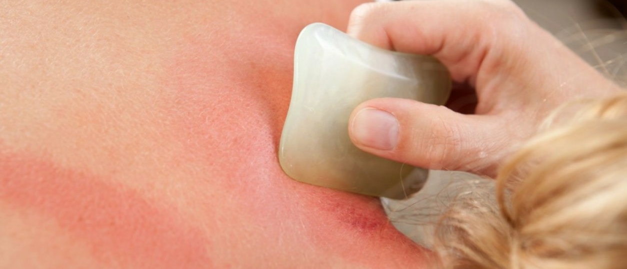 Wat is guasha therapie?