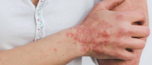 Je huid liegt nooit; wat huidklachten je duidelijk maken!