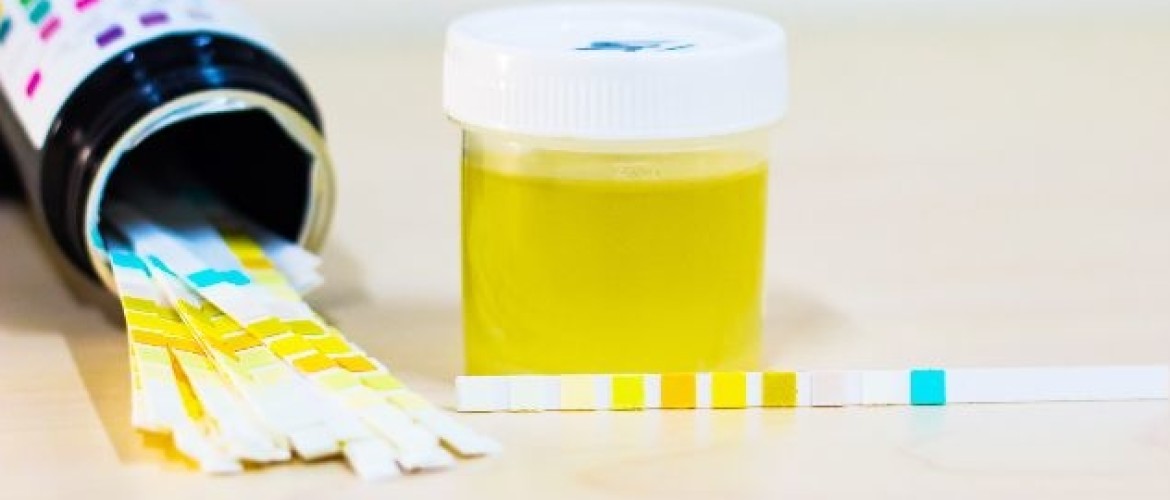 Ketose strips, uitleg gebruik en aanbiedingen!