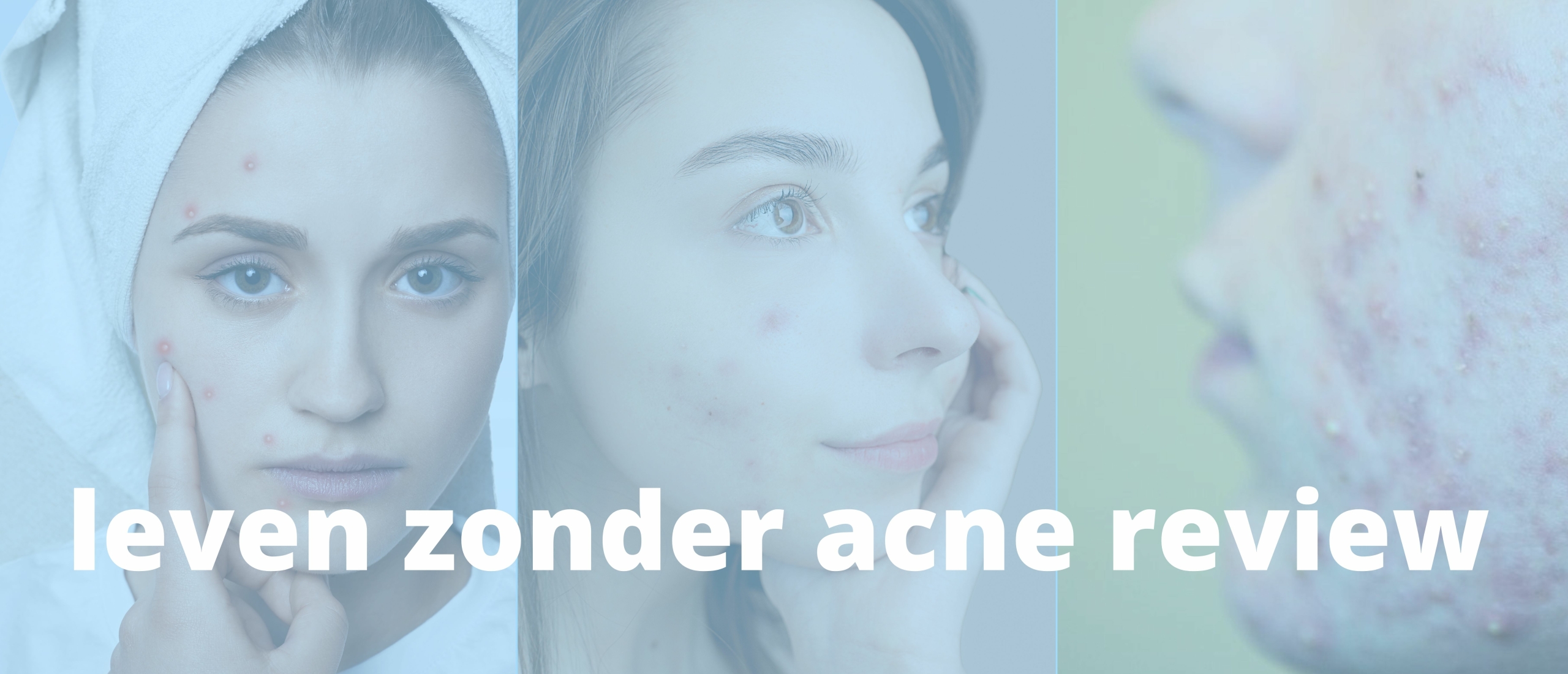 Review Leven Zonder Acne programma: Voorgoed geen puistjes meer?