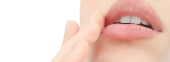 Gescheurde mondhoeken | Zo kom je er snel vanaf! | Advies huidtherapeut