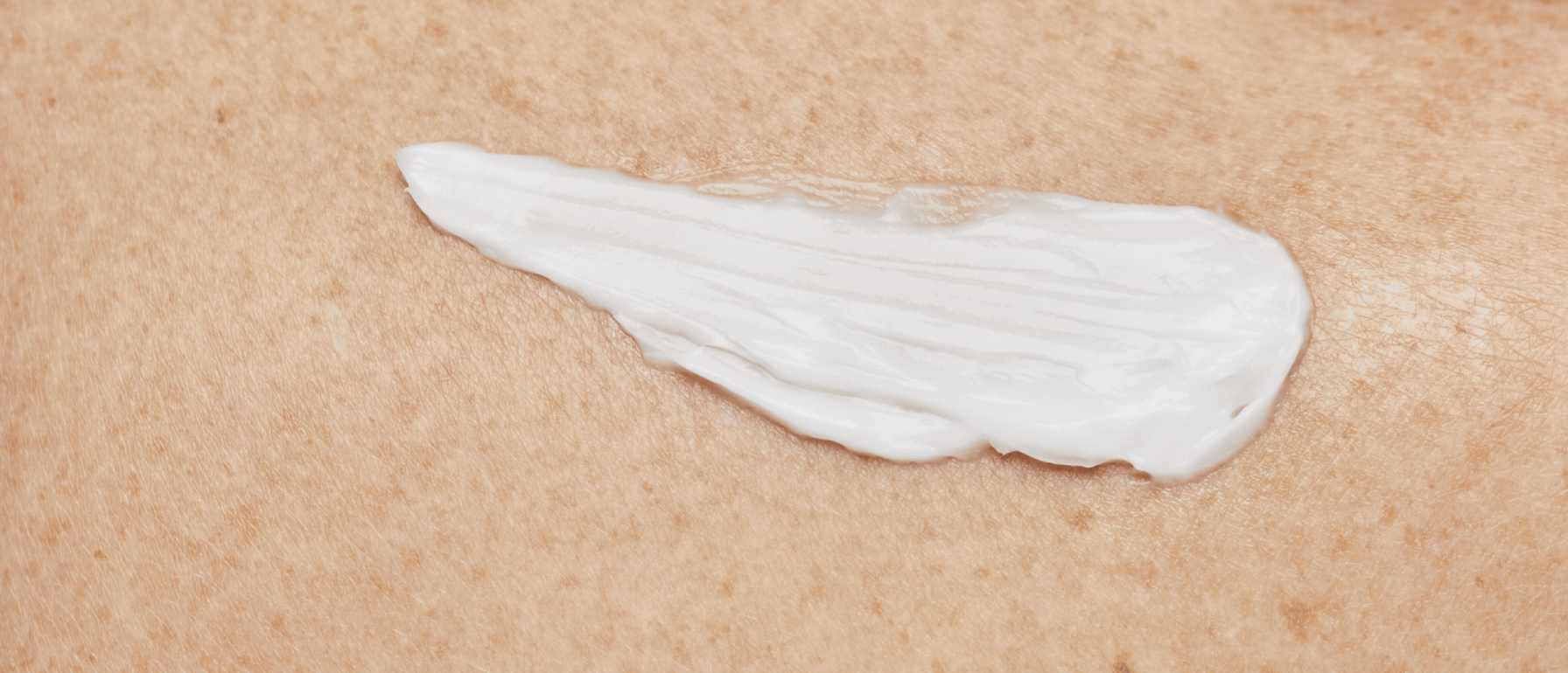 Is Sudocreme goed voor je gezicht? Wat mij betreft niet...