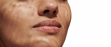 Make-up in de zon: mijn tips als huidtherapeut