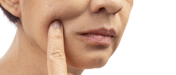 Effecten van roken op je huid