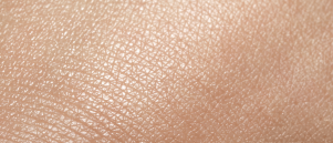 Droge huid winter: hoe kom je snel vanaf?