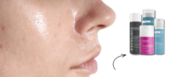 Paulas Choice vette huid gezicht