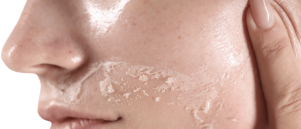 Voorkom deze veelgemaakte fouten bij de verzorging van je huid