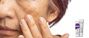 Retinol routine voor de eerste rimpels en pigmentvlekken