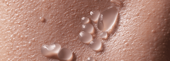 Warmtebultjes | Oorzaak en Tips | Sproet