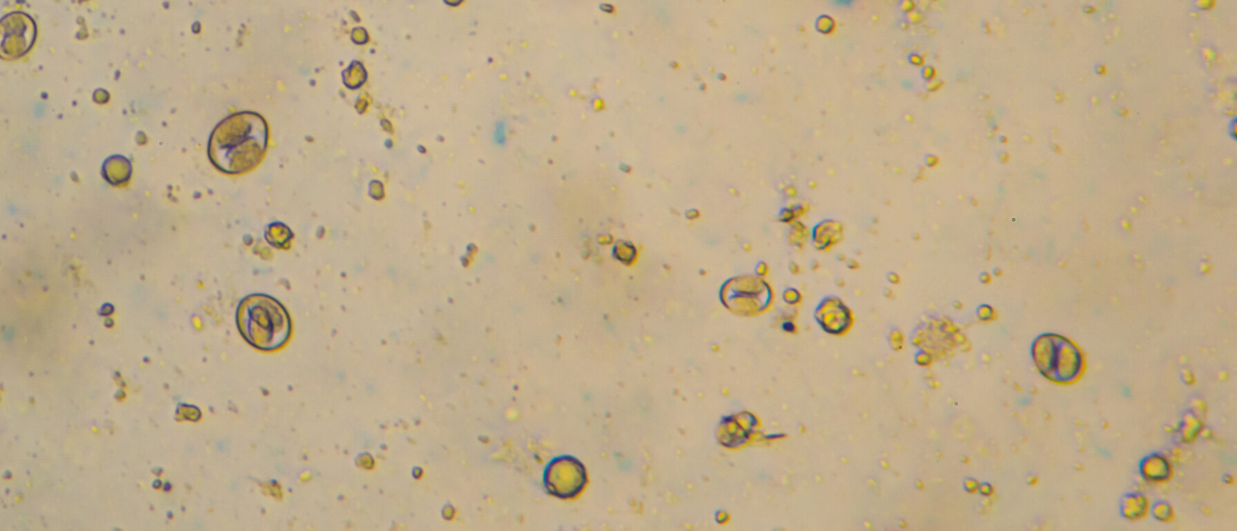 Eimeriaparasiet Coccidiose Kippen Kennisbank Kippenpakket.nl