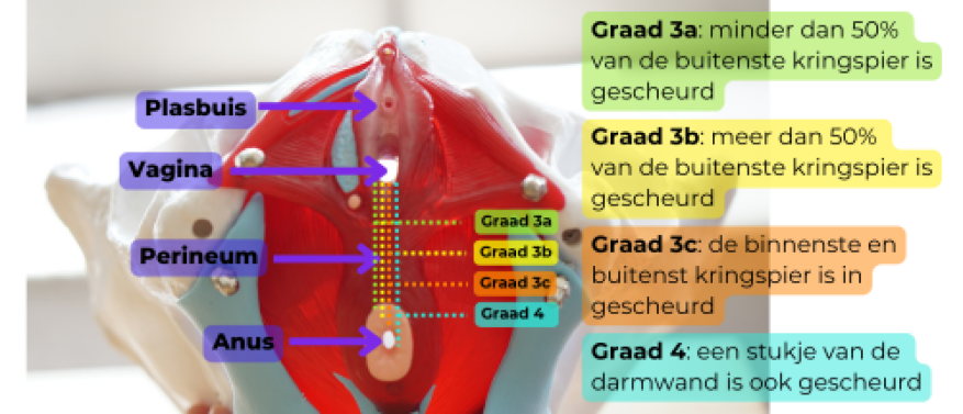 Wat is een totaalruptuur? Oorzaken, gradaties en uitleg