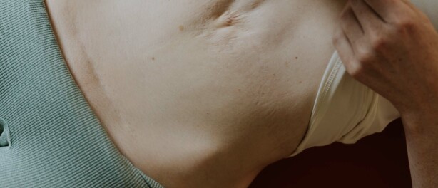 Buikspieroefeningen na een keizersnede: veilig starten in de kraamtijd