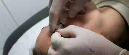 “De vorige piercer heeft het fout gedaan”