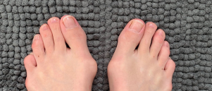 Hoe weet Voetentraining welke voetklacht ik heb?