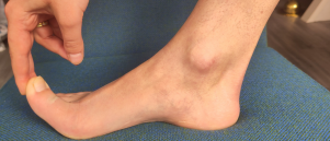 Waar kan ik mijn voeten gratis laten checken bij pijnklachten?