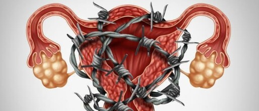 Endometriose: Alles wat je moet weten over deze chronische aandoening