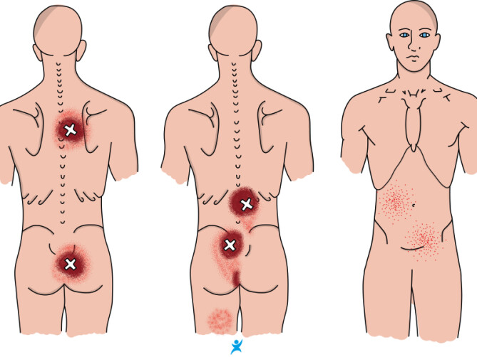 Gratis Ebook - De oplossing voor pijn!