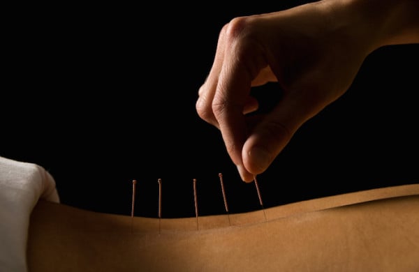 Wat is acupunctuur en hoe werkt het?