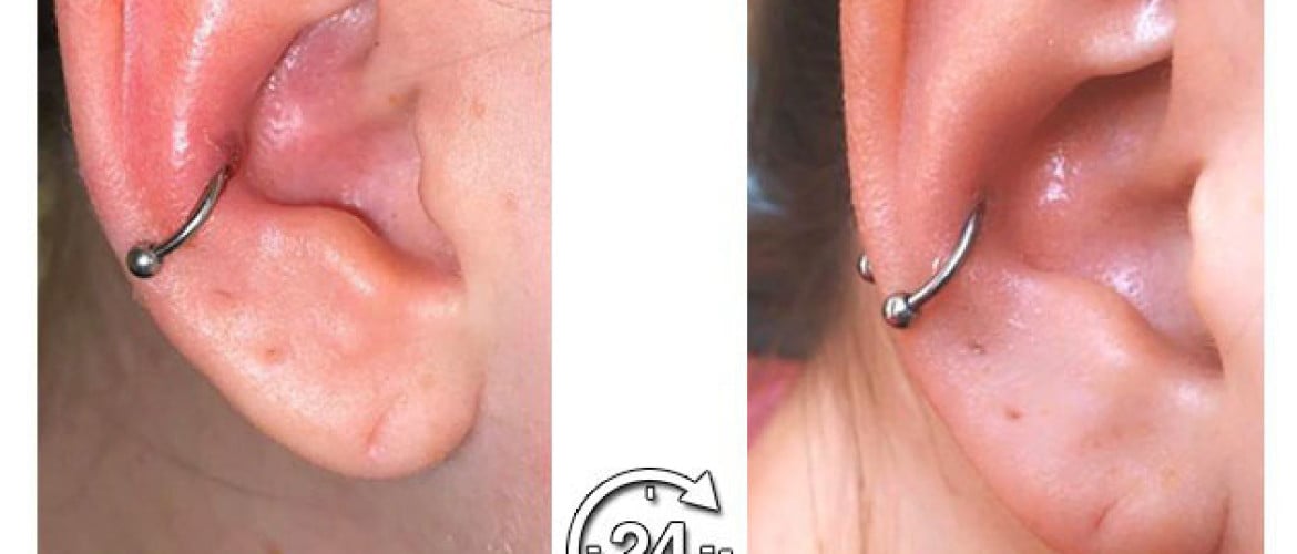 Jouw piercing soepel en snel genezen / Fast and simple healing for your piercing