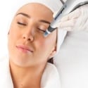 Microneedling Rotterdam