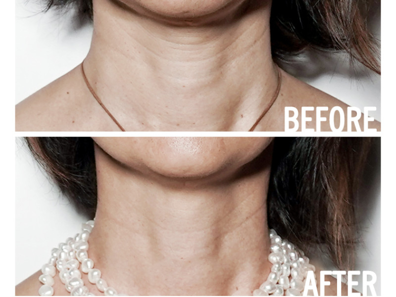 access bars energetische facelift yoga amsterdam bluebirds barsbabes mindset coach bewustzijn