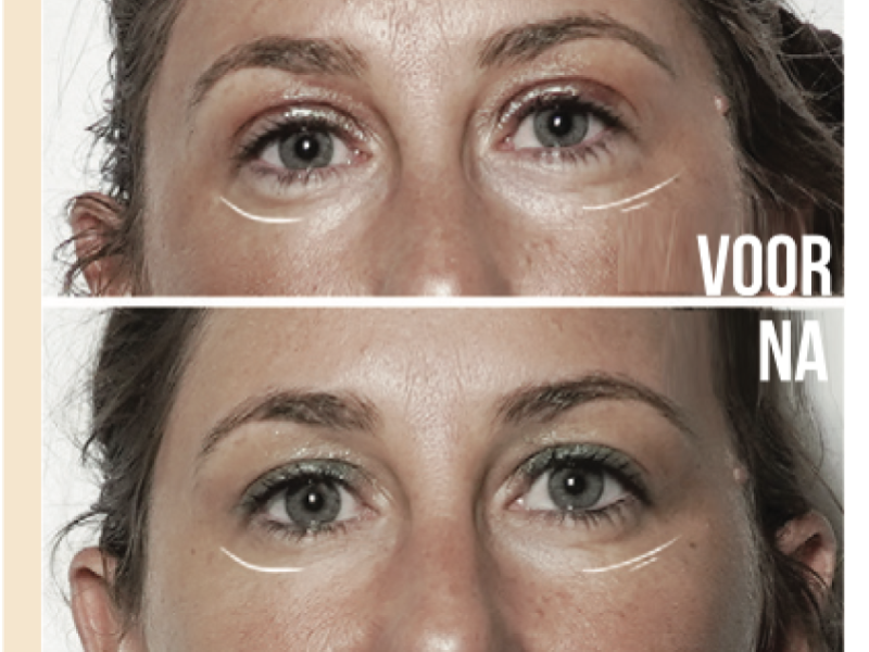 access bars energetische facelift yoga amsterdam bluebirds barsbabes mindset coach bewustzijn