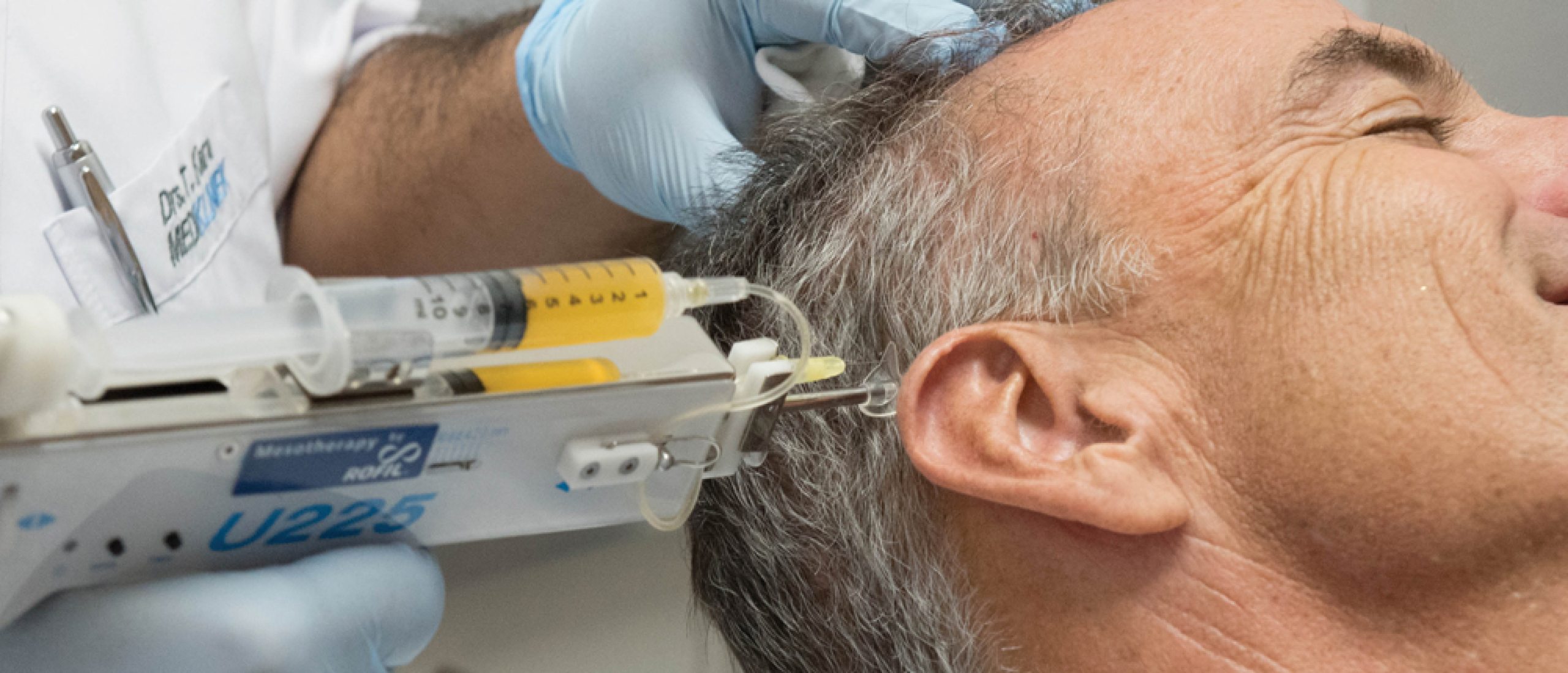 PRP Haargroeistimulatie PRP Haargroeistimulatie