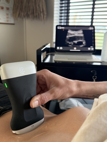 Echografie van een diastase, verzakking, blaas, bekkenbodem, darm