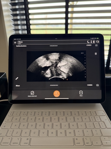 Echografie van de buikspieren