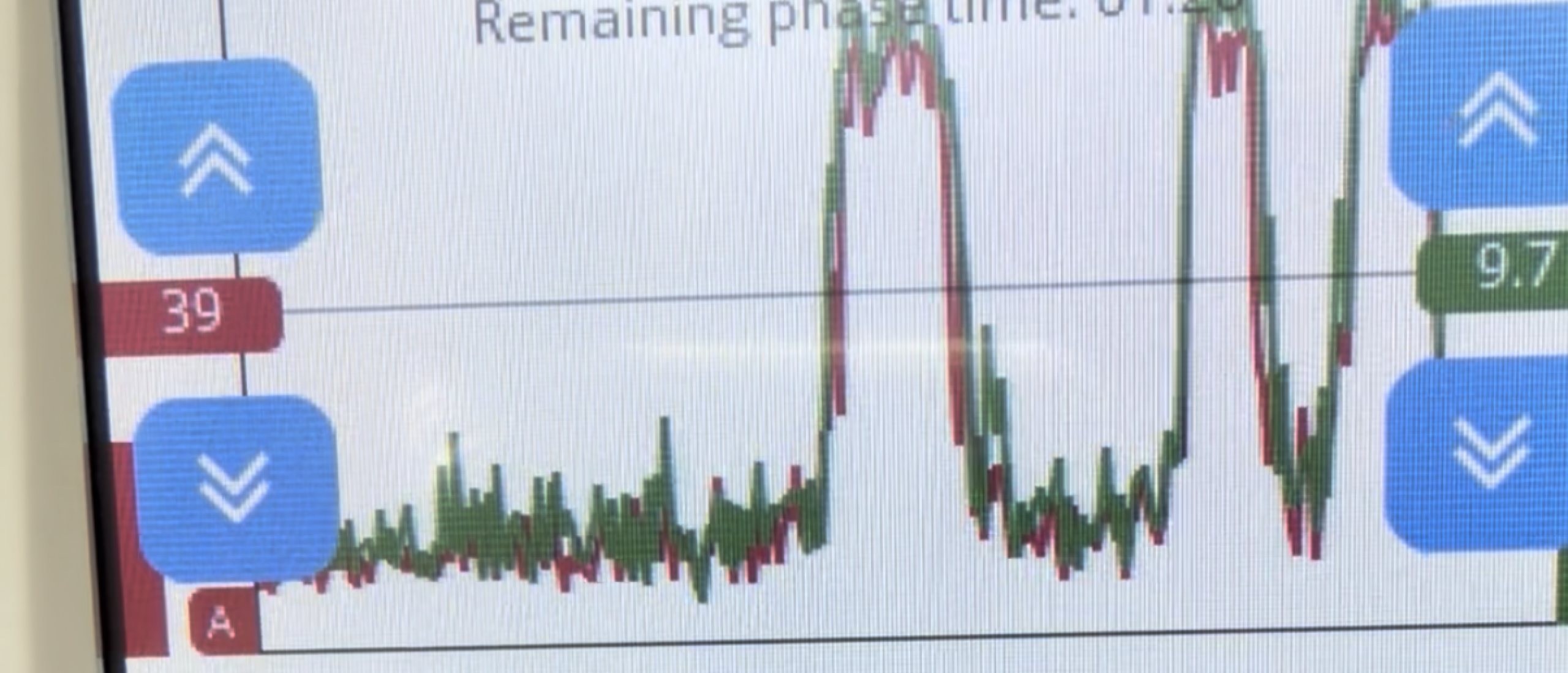 EMG bij de bekkenfysiotherapeut