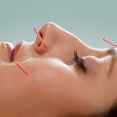 cosmetische acupunctuur Eindhoven en anti aging