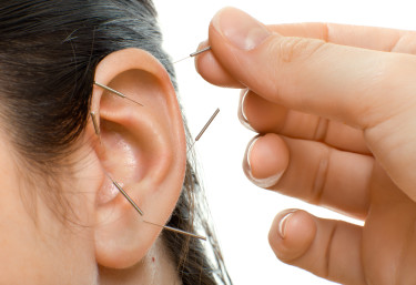 oor acupunctuur